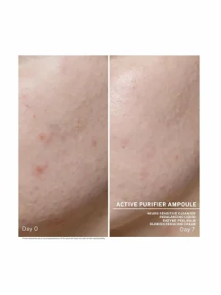 Kasvojenhoito-Babor Ampoule Concentrates Active Purifyer -ampullit 7 x 2 ml
