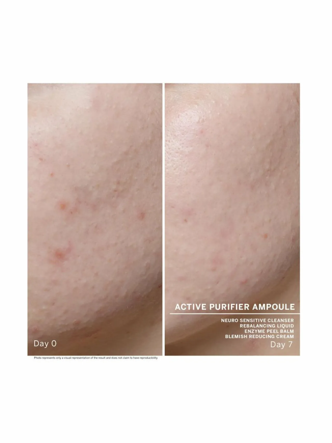 Kasvojenhoito-Babor Ampoule Concentrates Active Purifyer -ampullit 7 x 2 ml