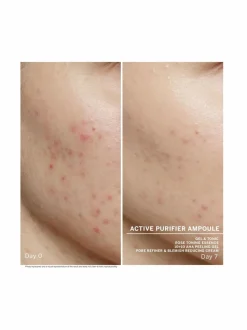Kasvojenhoito-Babor Ampoule Concentrates Active Purifyer -ampullit 7 x 2 ml