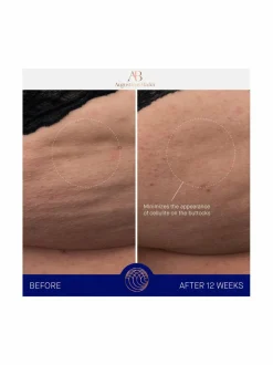 Vartalonhoito-Augustinus Bader The Body Cream -ylellinen vartalovoide