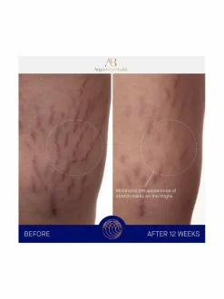 Vartalonhoito-Augustinus Bader The Body Cream -ylellinen vartalovoide