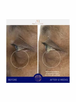 Kasvojenhoito-Augustinus Bader The Eye Cream Nomad - silmänympärysvoide