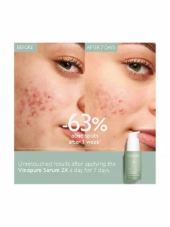 Kasvojenhoito-Caudalie Vinopure Blemish Control Salicylic Serum -seerumi, 30ml