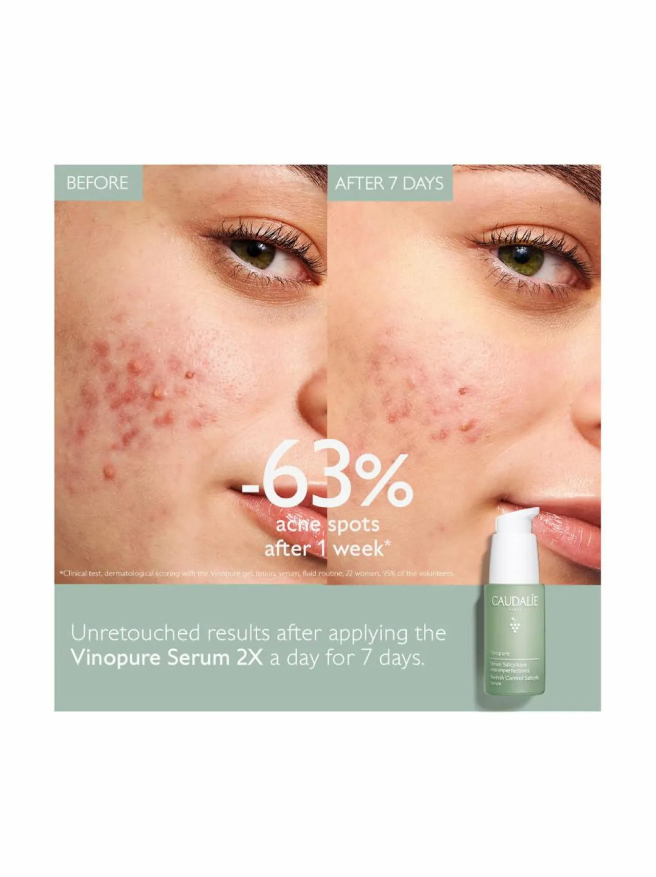 Kasvojenhoito-Caudalie Vinopure Blemish Control Salicylic Serum -seerumi, 30ml